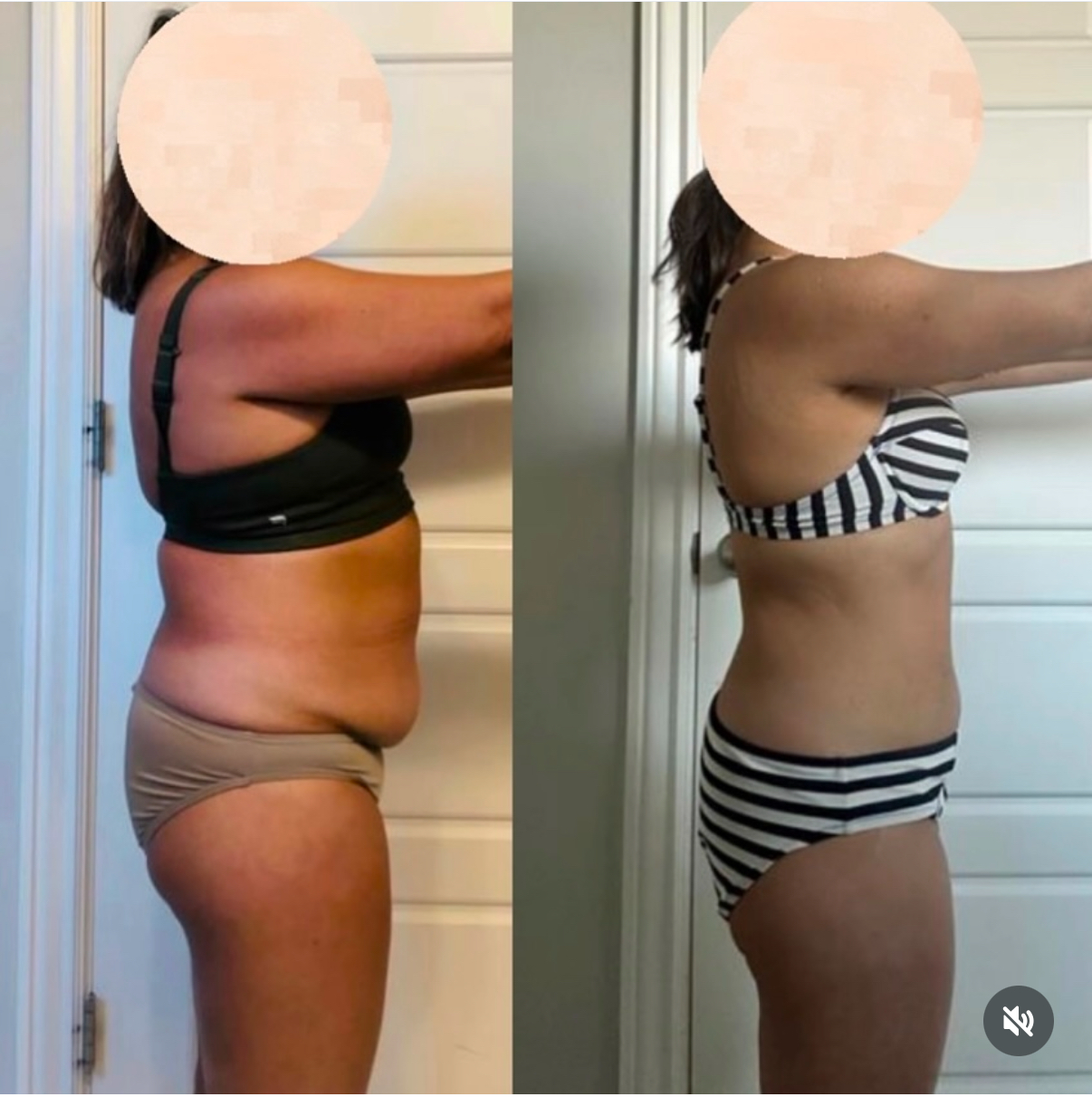Client side-view before-and-after comparison