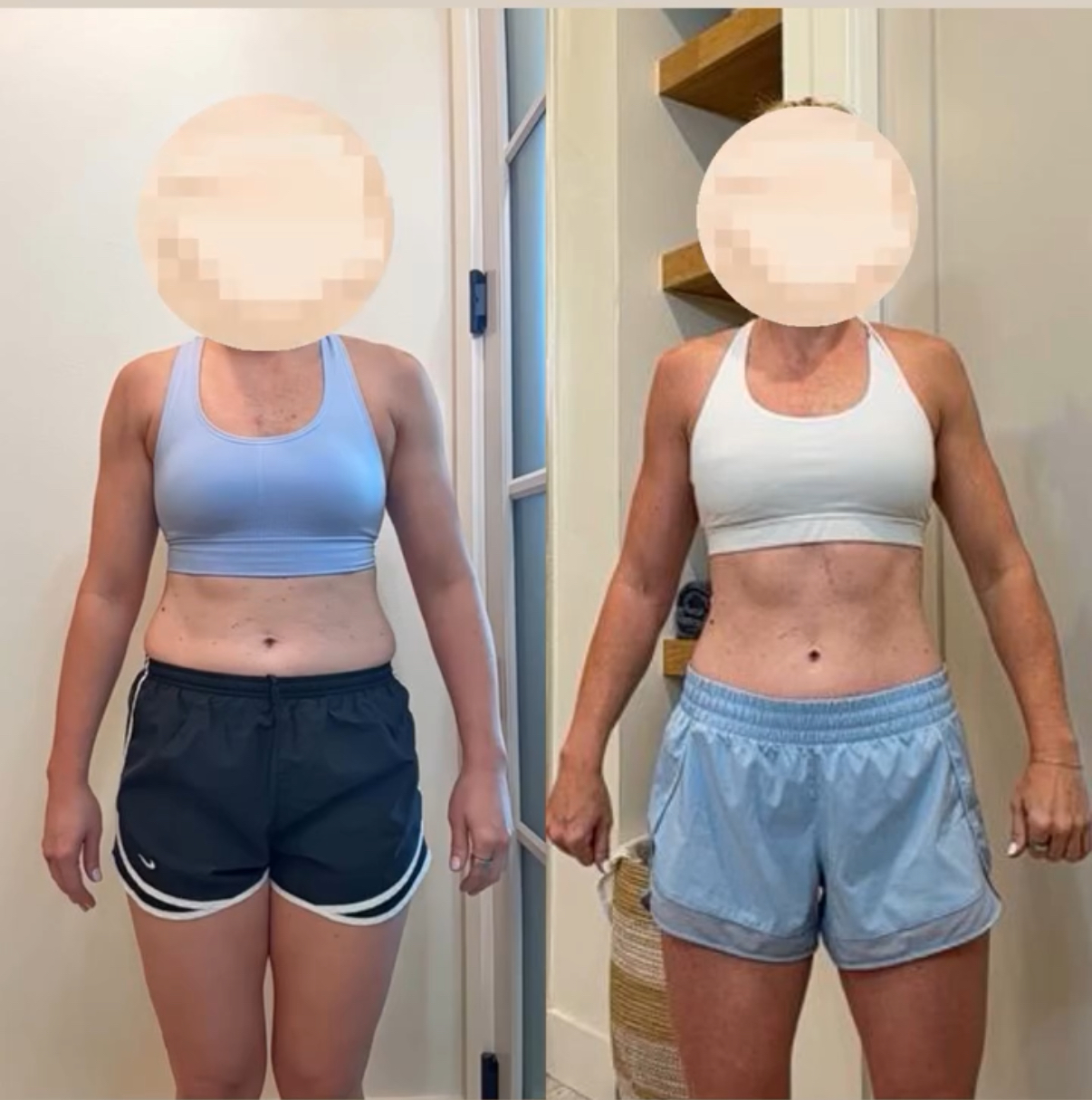Client front-view before-and-after comparison