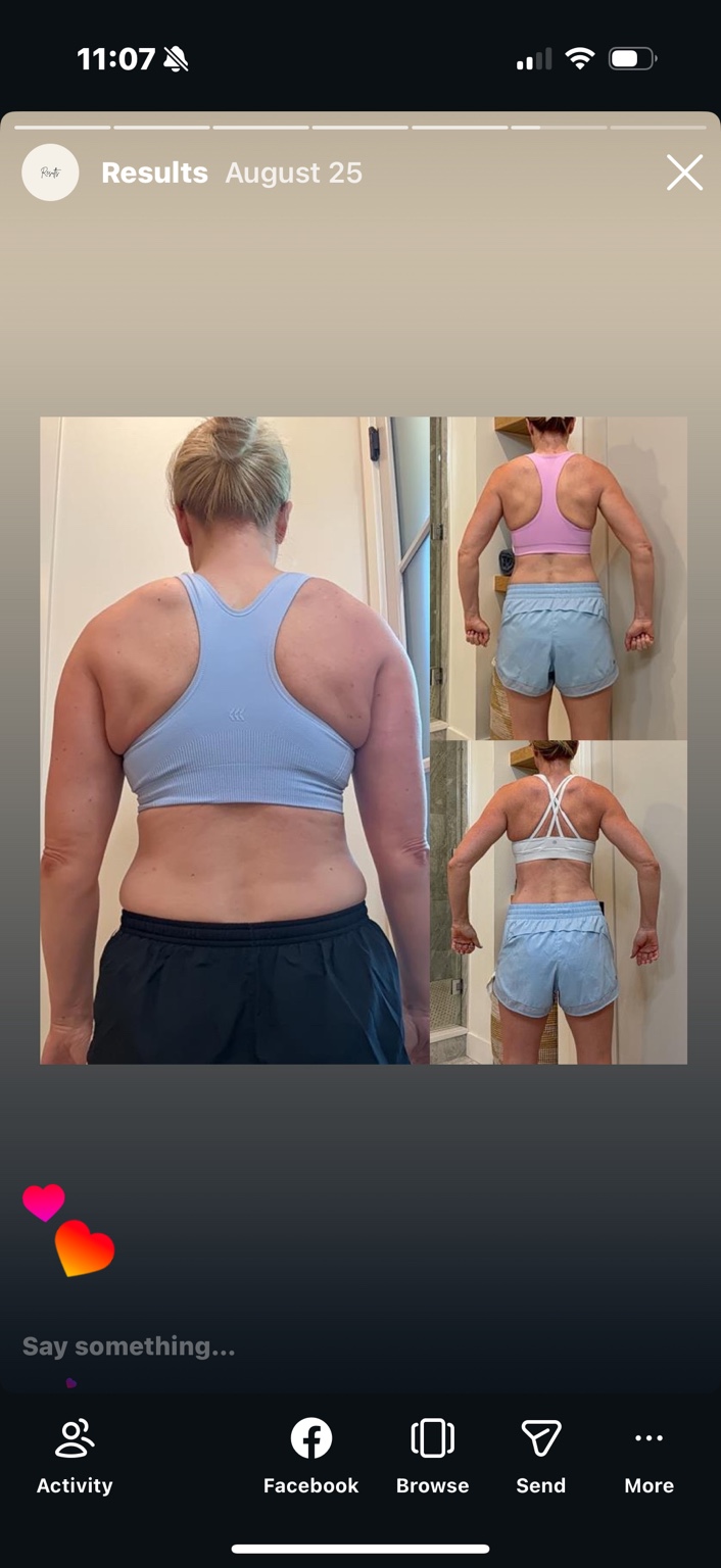 Client back-view progress comparison in three photos
